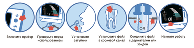 Апекс локатор этапы применения