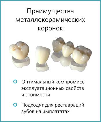 Преимущества металлокерамических коронок