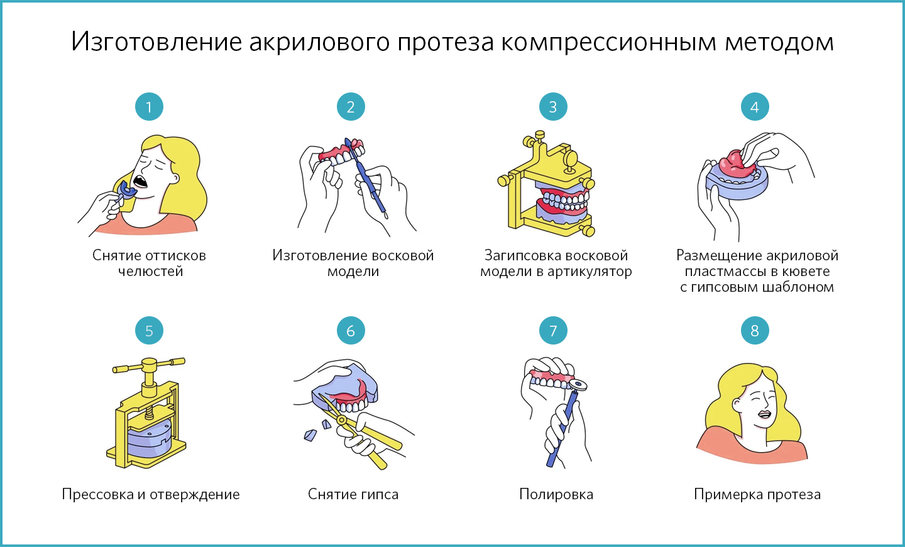 Один из вариантов производства акриловых протезов