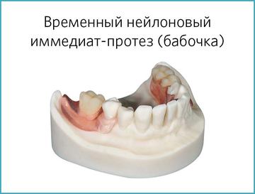 Временные протезы нейлоновые