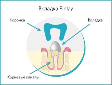 Вкладка Pinlay пинлей