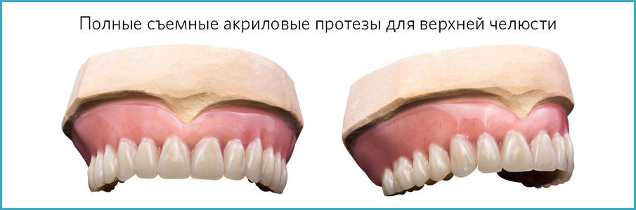Акриловый протез для верхней челюсти
