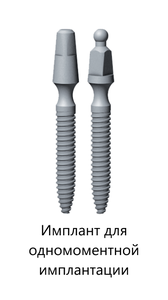 Имплант и абатмент