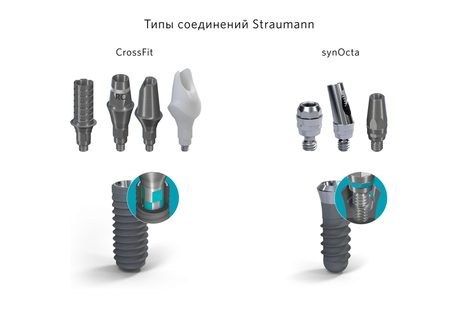 Типы соединений имплантатов Straumann