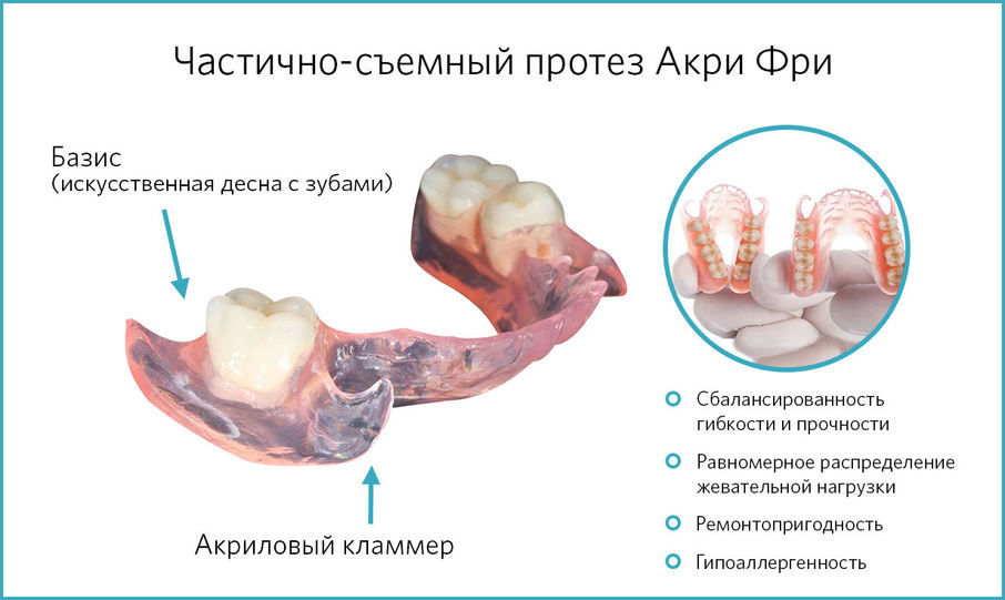 Частично-съемный протез Акри Фри