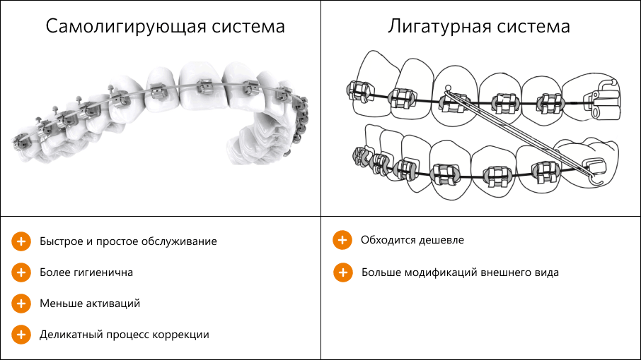 Сравнение самолигирующих и лигатурных систем Сравнение самолигирующих и лигатурных систем